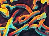 Ebola-Virus: Das Virus verursacht Fieber mit inneren Blutungen.  Die Krankheit ist in bis zu 90 Prozent der Fälle tödlich.  Wissenschaftler arbeiten hart an einem Impfstoff.
