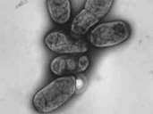 Pestpathogen Yersinia pestis: Die Infektionskrankheit wurde erstmals im 6. Jahrhundert im Mittelmeerraum entdeckt.  Die Bakterien wurden 1894 entdeckt. Heutzutage sind die Heilungschancen mit Antibiotika hoch, wenn sie früh diagnostiziert werden.