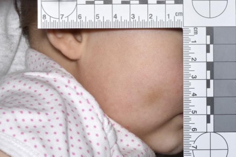 Thoughtlessly polluted: behavior and behavior - Pediatric Switzerland