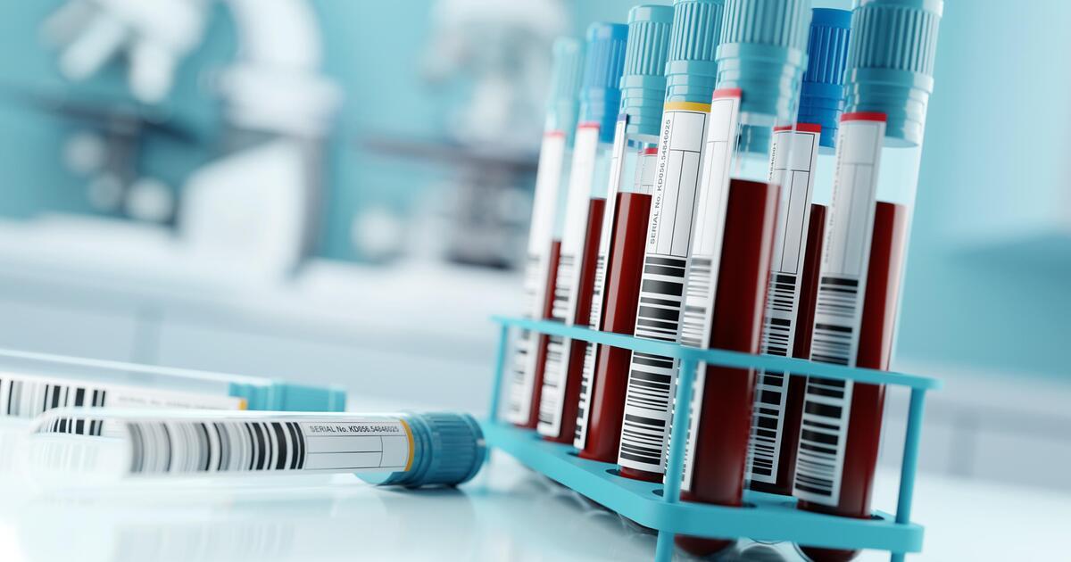The new test can change the treatment of many sclerosis |