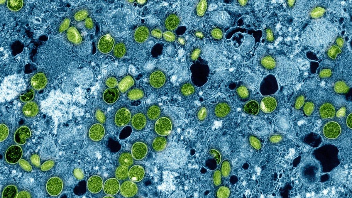 MPX VARNER: Resees Die Forscher fragen nach Schritten Virus