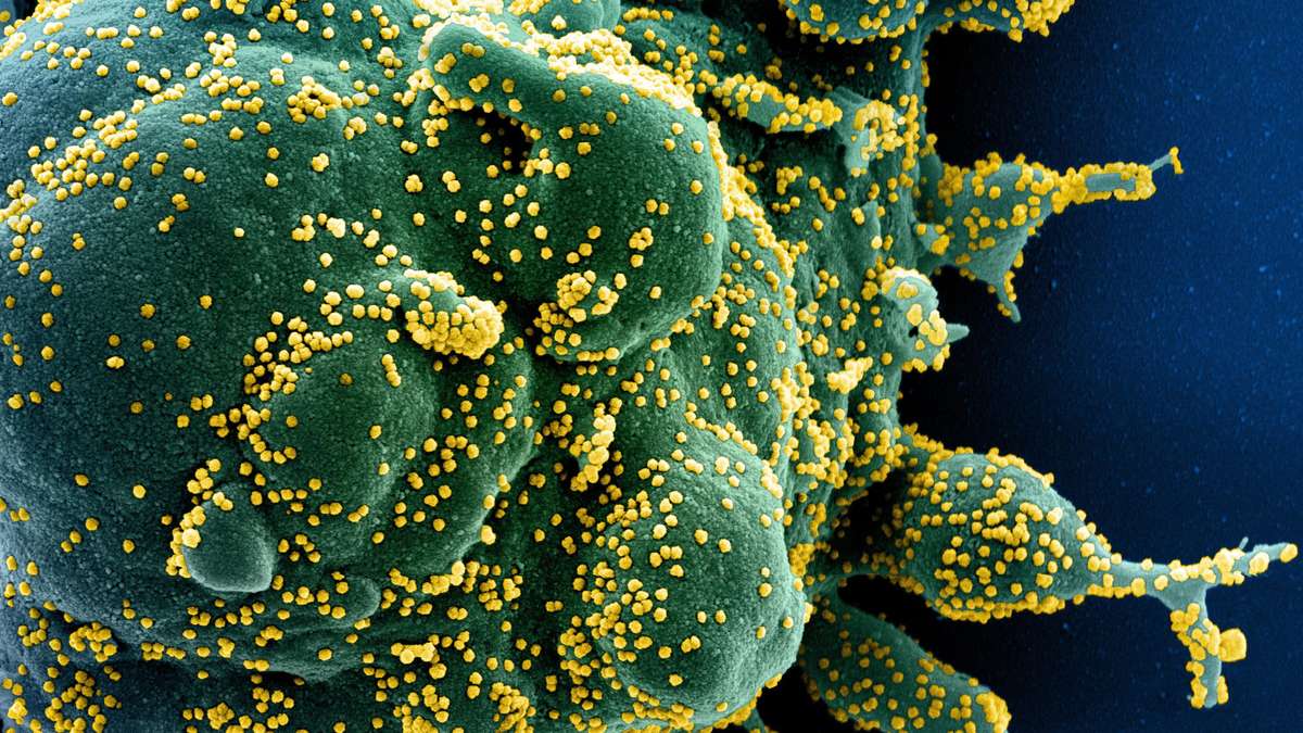 Coronavirus: Immunsystem als Virus-Helfer? Wissenschaftler decken fatales Zusammenspiel auf