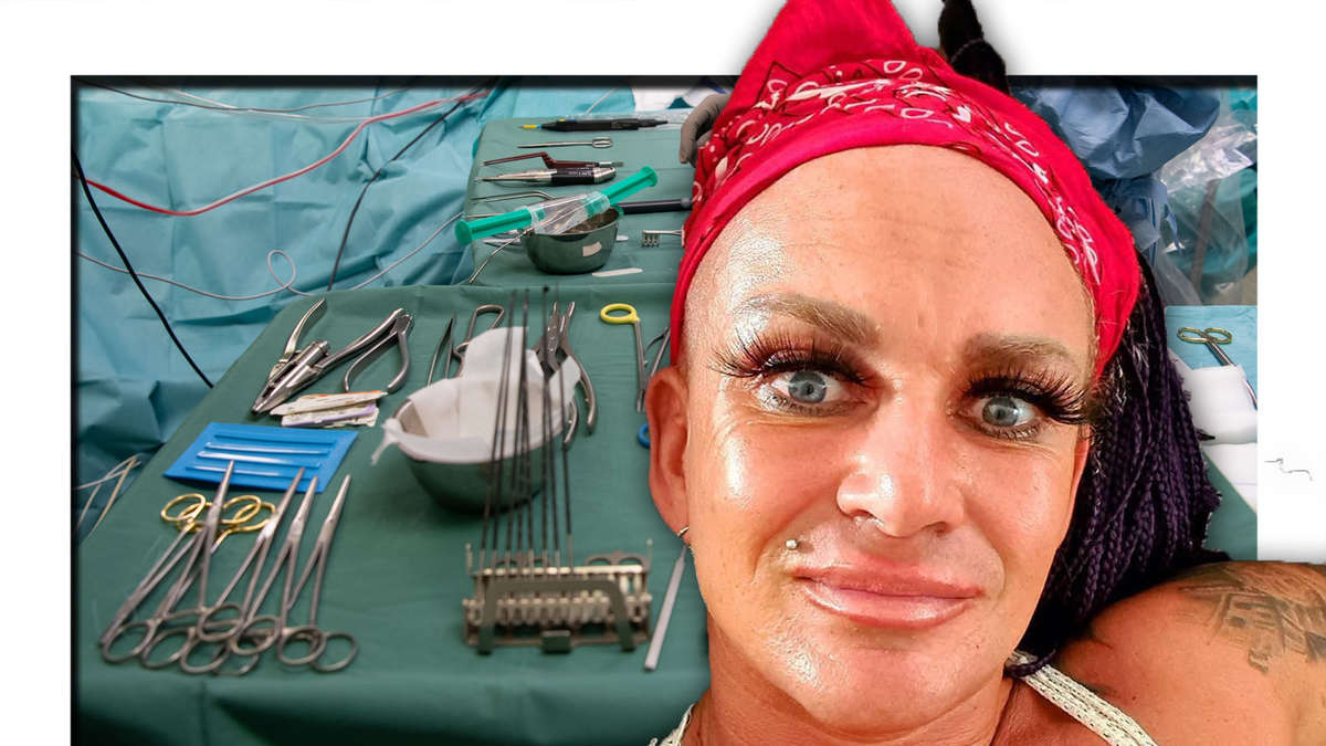 Auf Wiedersehen Deutschland (Vox): Caro Robens will weiblicher wirken - die Auswandererin hat ihr gesamtes Gesicht operiert