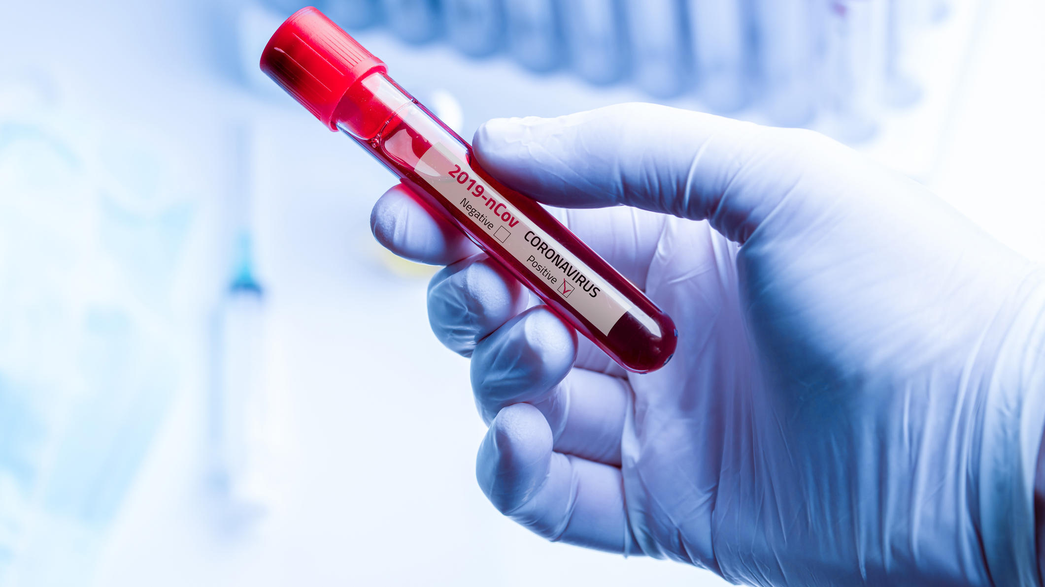 Geringeres Koronarisiko bei Blutgruppe 0: Aktuelle Studien bestätigen den Zusammenhang