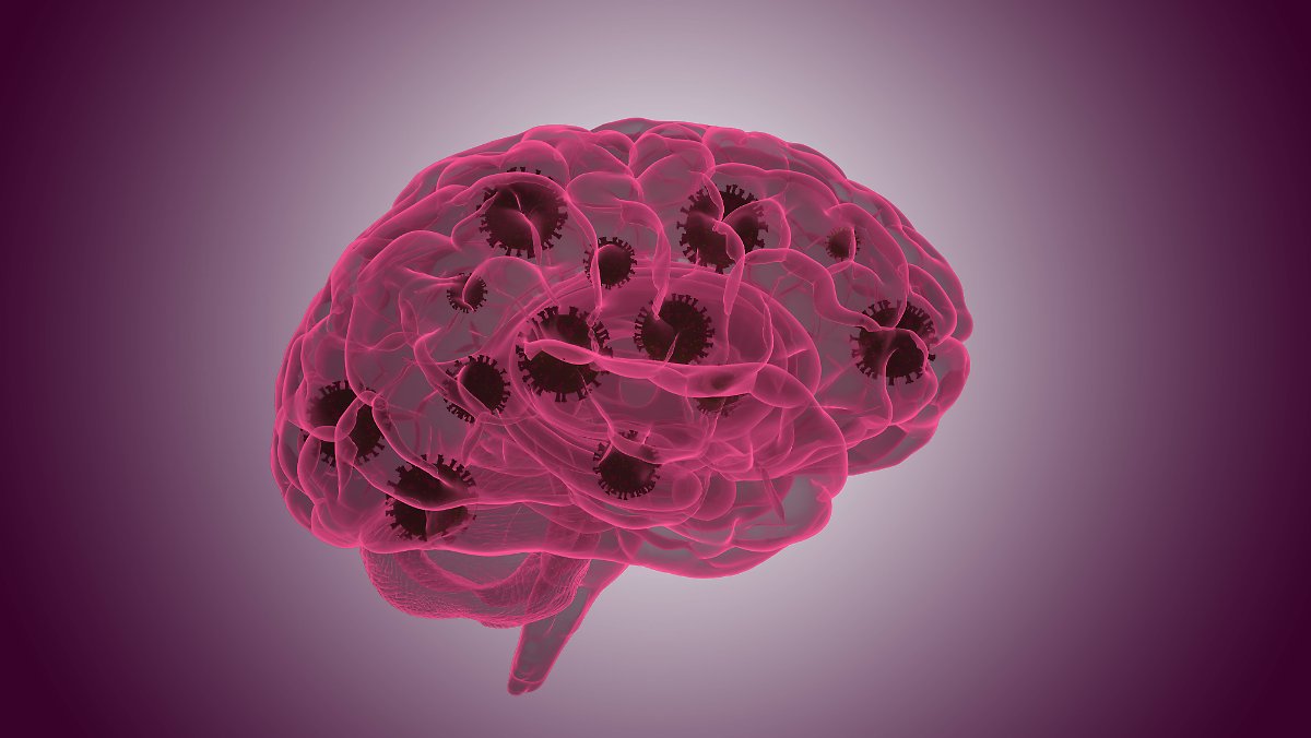 Ergebnisse beim Verstorbenen: Wie Sars-CoV-2 seinen Weg ins Gehirn findet