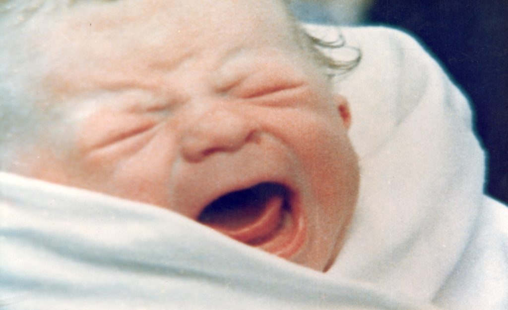Baby mit Zwilling im Mutterleib geboren in extrem seltener Schwangerschaft
